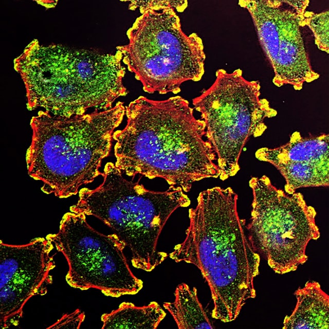 Immune cells illustrating autoimmune and allergy care
