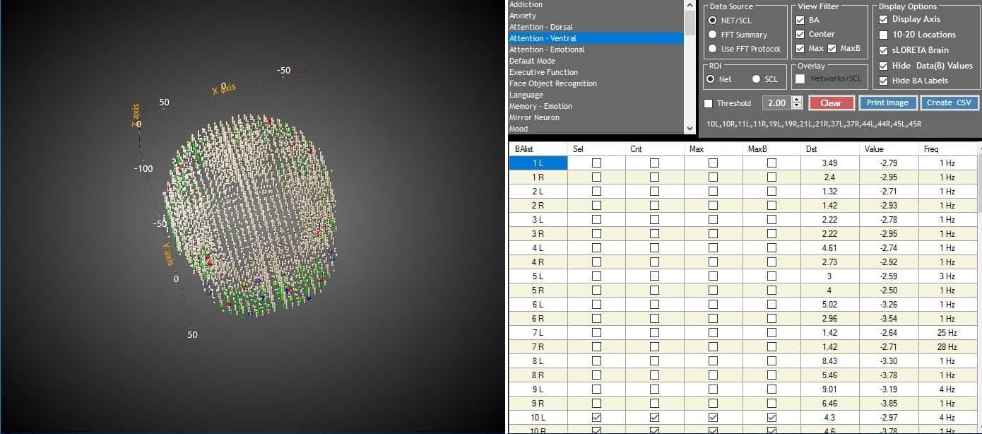 concussion-diagnosis 2
